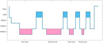 Sleep Quality Detection Based on EEG Signals Using Transfer Support Vector Machine Algorithm